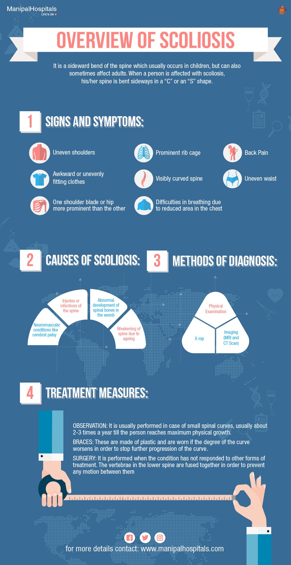 Overview of Scoliosis