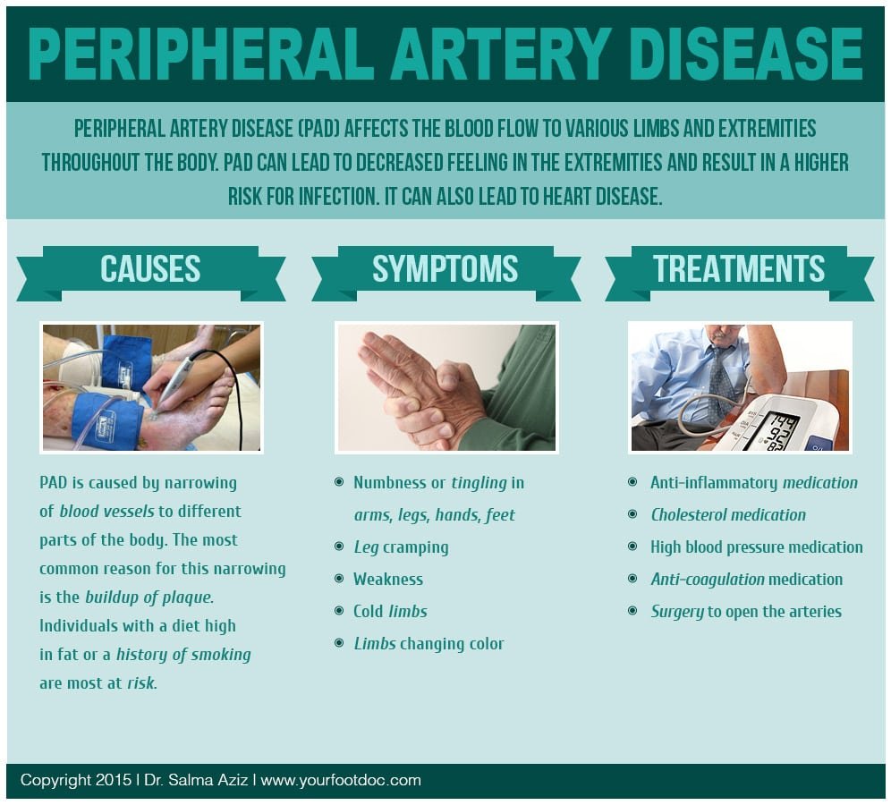 Peripheral Artery Disease