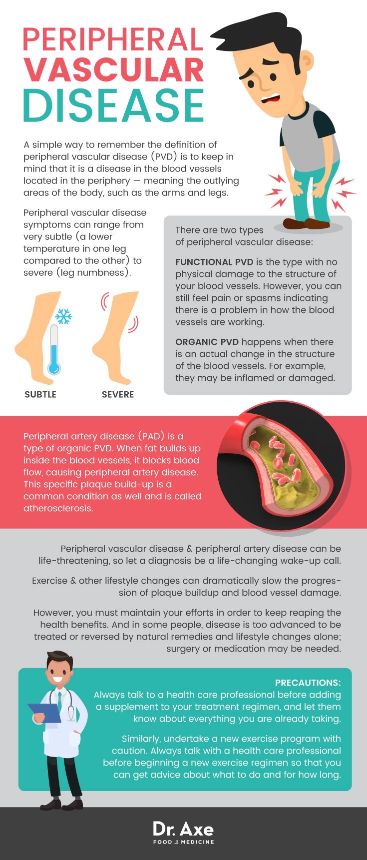 Peripheral Vascular Disease