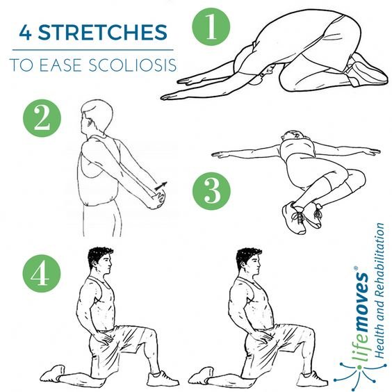 Stretches to ease Scoliosis