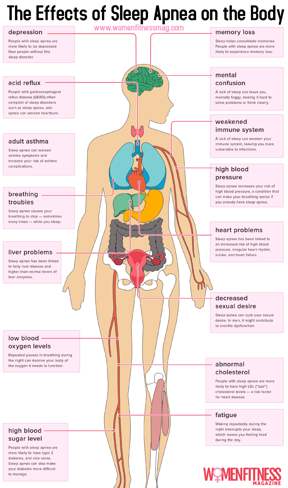 The Effects of Sleep Apnea on the Body