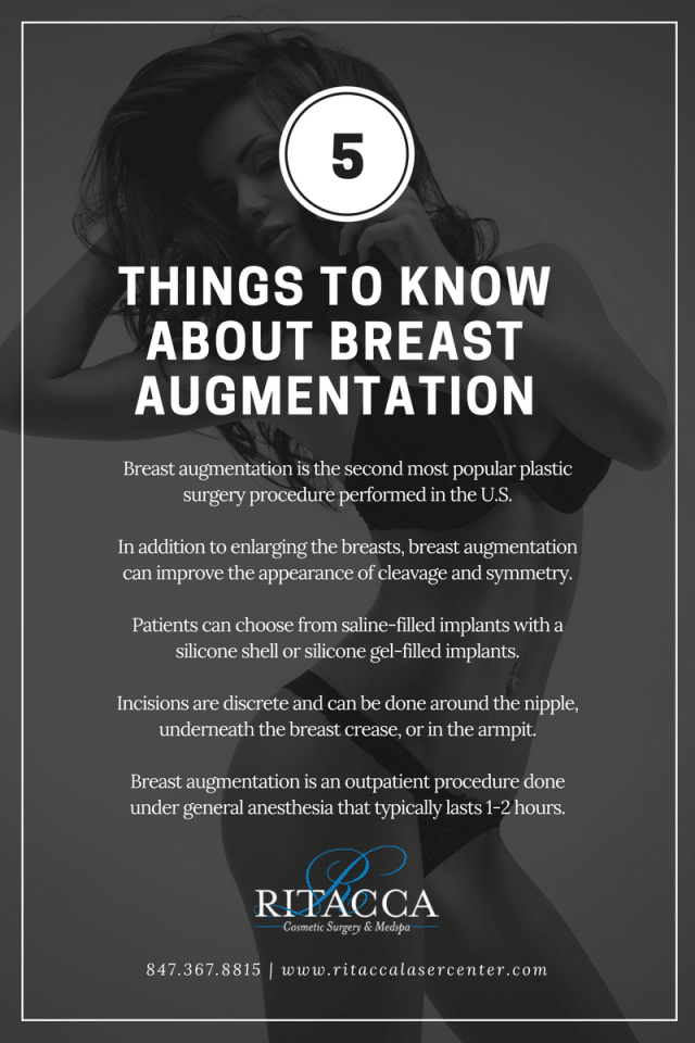 Things to know about Breast Augmentation