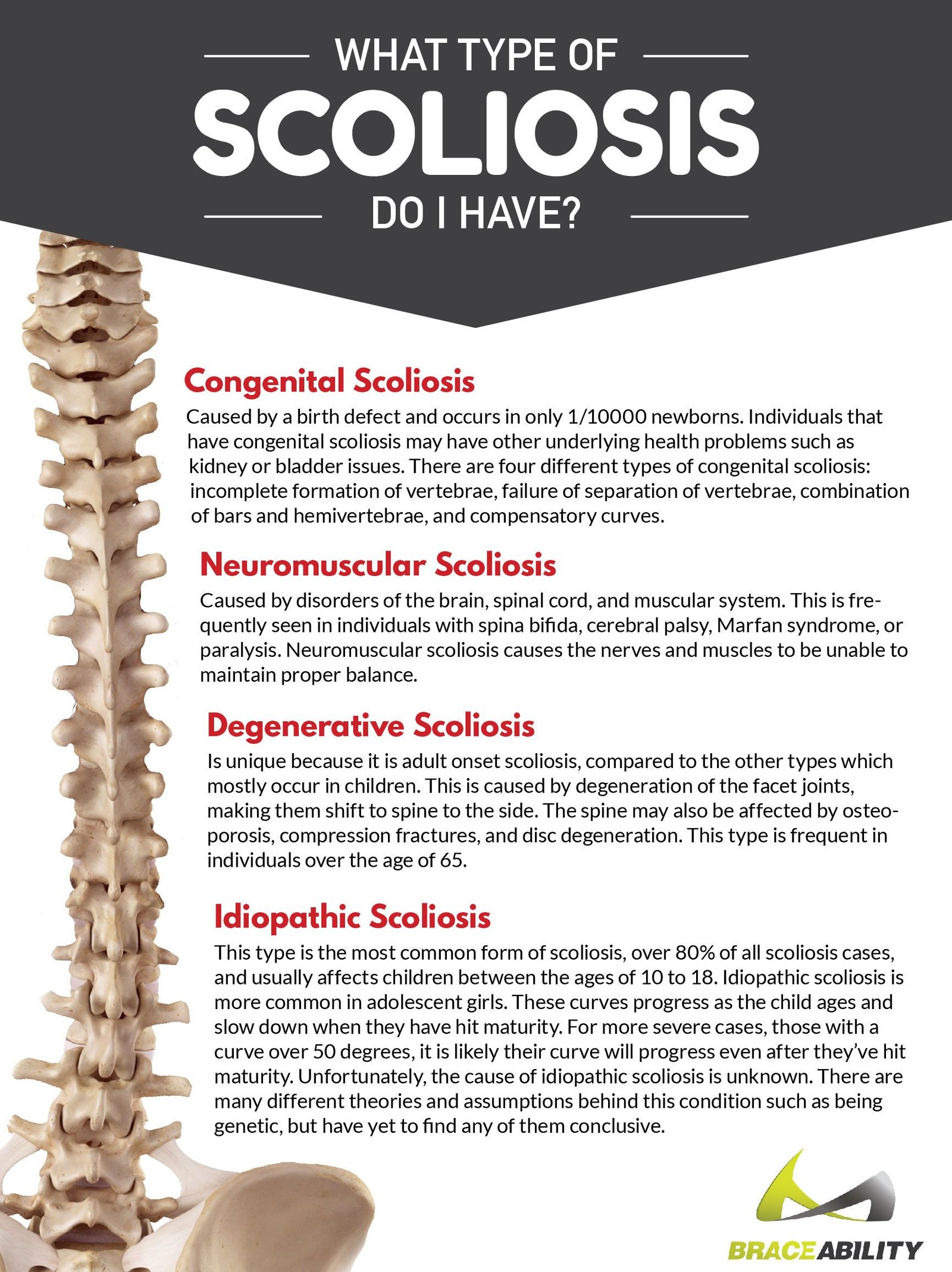 Types of Scoliosis