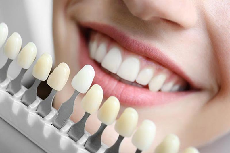 5 Ways Tooth Replacement Benefits Your Health