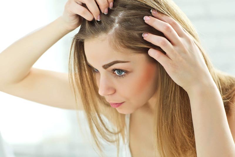 How To Combat Female Pattern Baldness