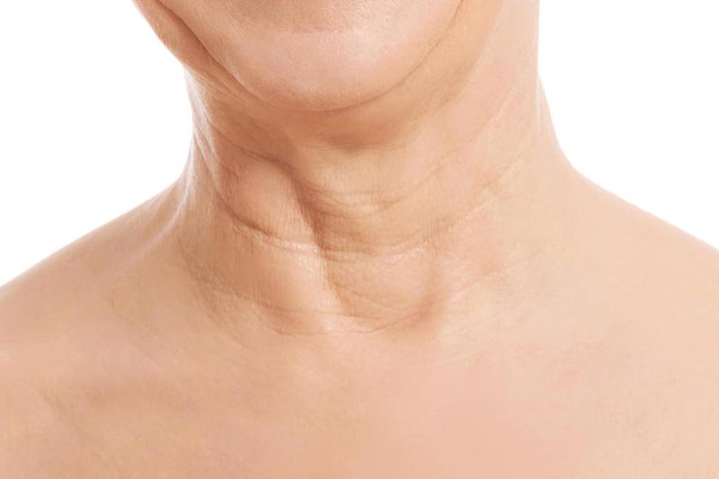 5 Ways To Fight Neck Aging