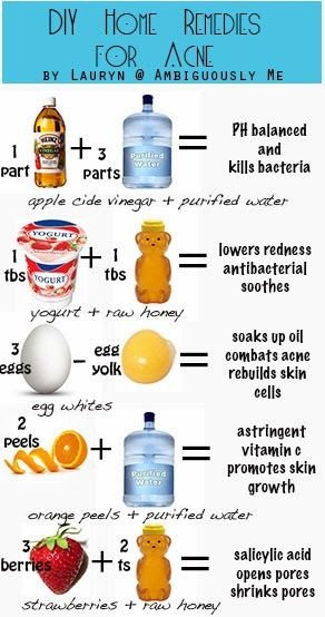 DIY Home Remedies for Acne