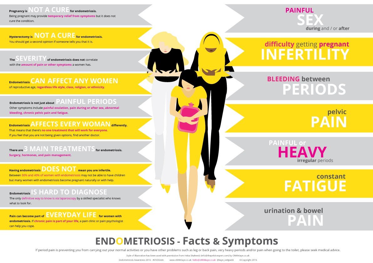 Endometriosis facts and symptoms