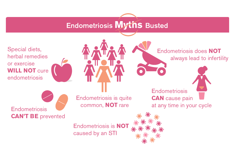 Endometriosis myths busted