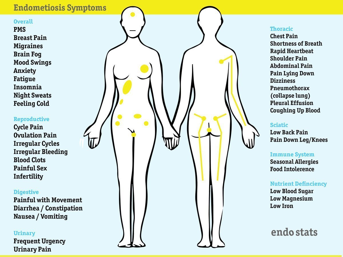 Endometriosis symptoms