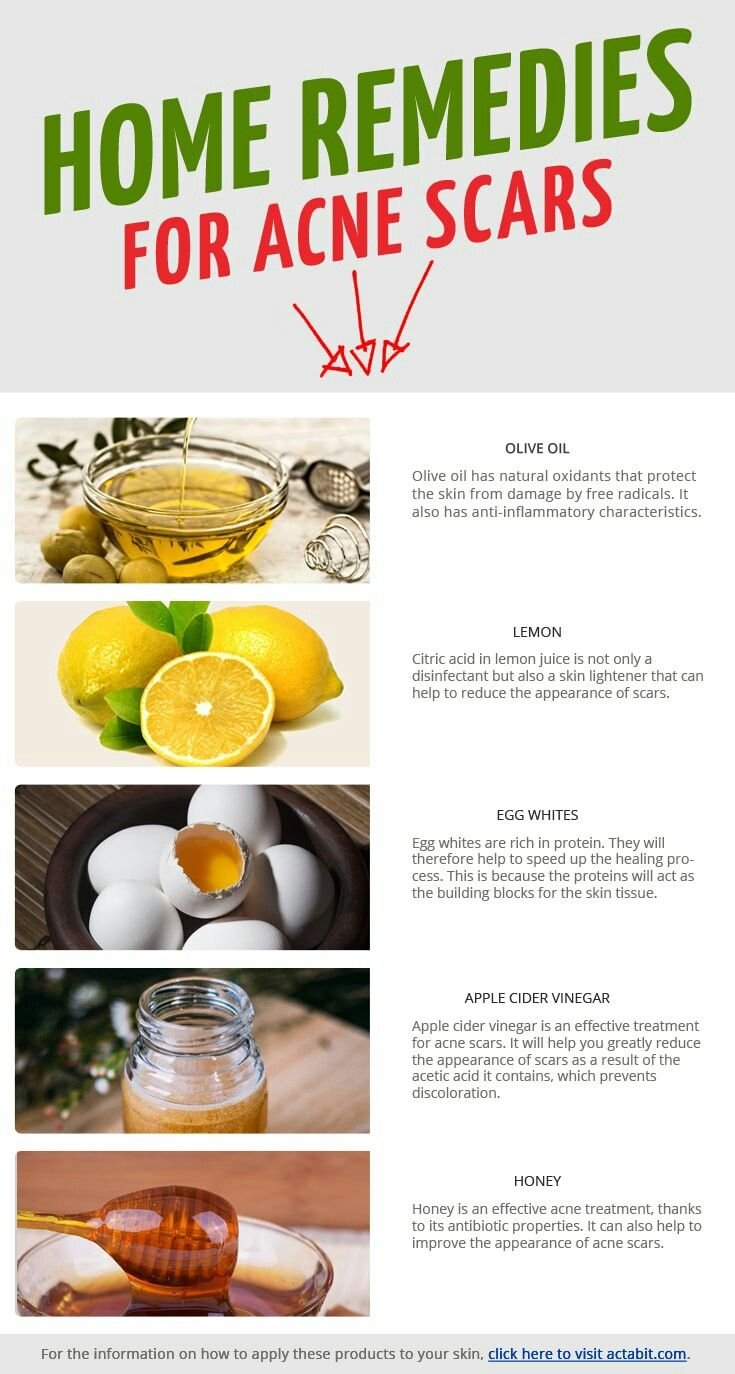 Home Remedies for Acne Scars