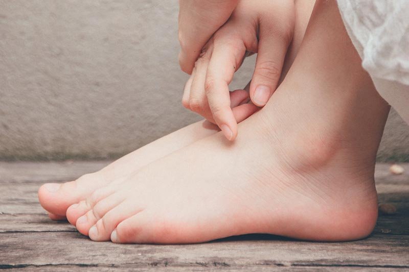 How to Recognize and Treat Ordinary Foot Disorders