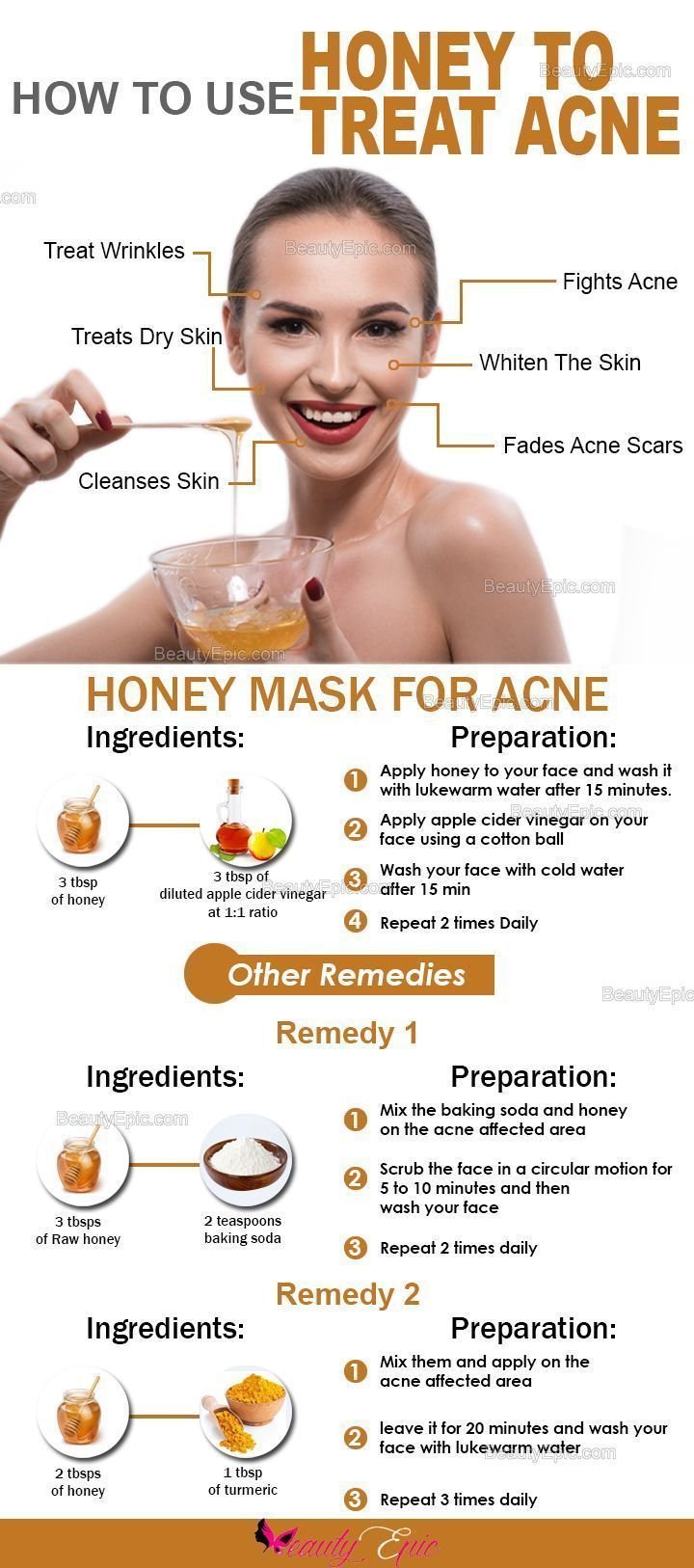 How to use Honey to Treat Acne