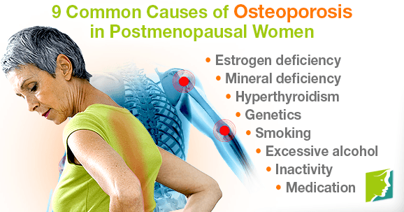 Common causes of osteoporosis in postmenopausal women