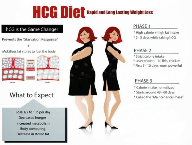HCG Diet Weight loss