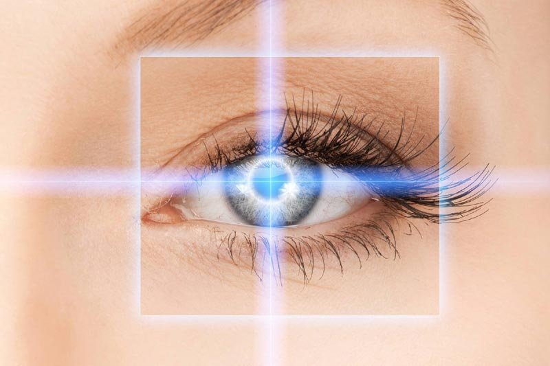 The Basics of LASIK Eye Surgery