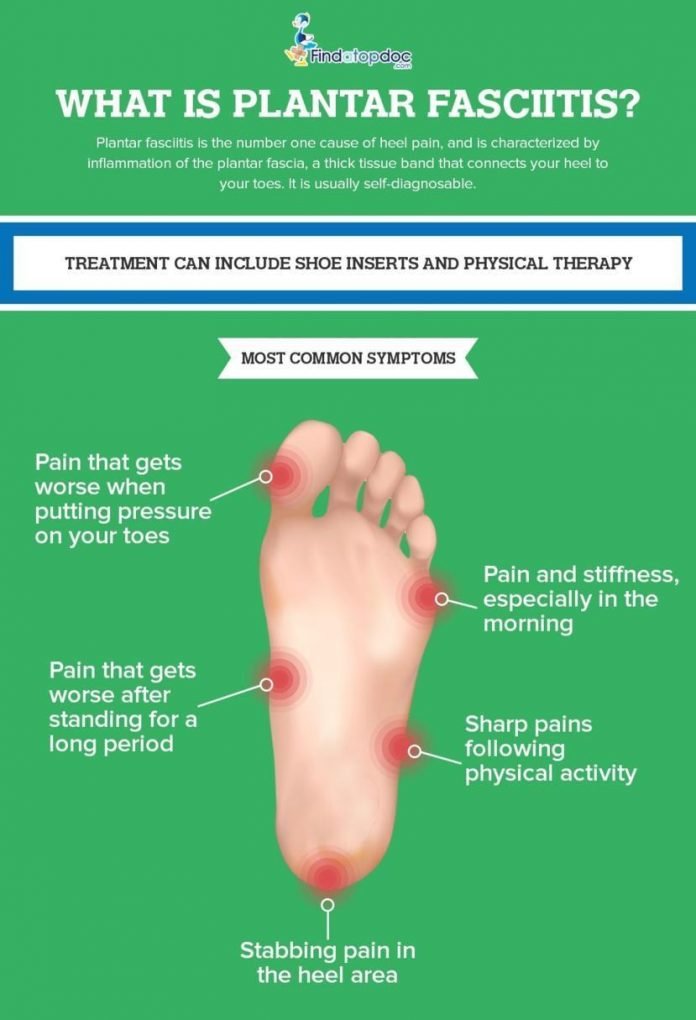 You Need To Know About Plantar Fasciitis - Women Fitness Magazine