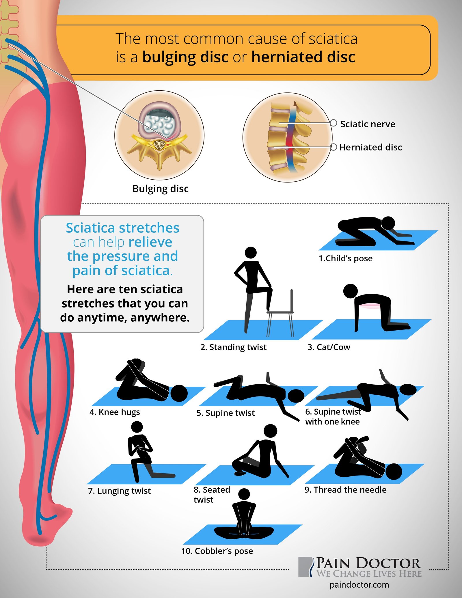 Sciatica stretches can help relieve the pressure and pain