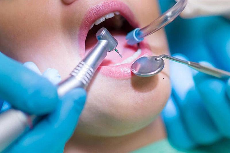 4 Most Common Dental Emergencies