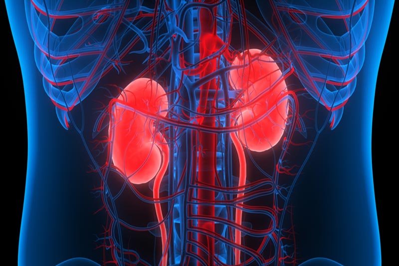 Kidney Problems