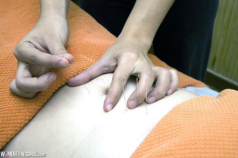 How Chinese Acupuncture Boosts Fertility: Does it Work?