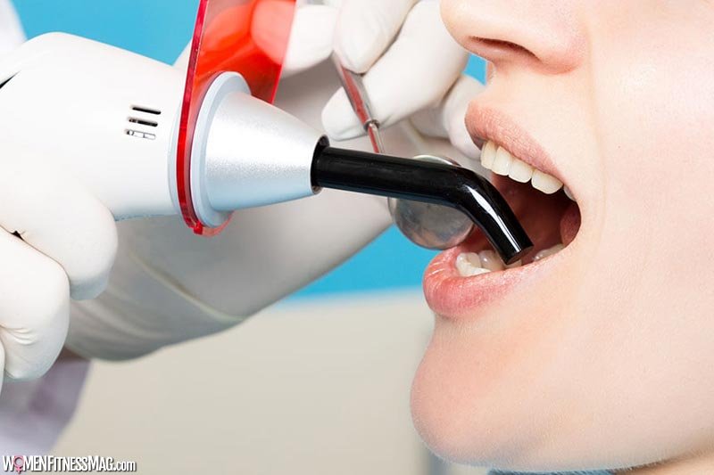 All You Need To Know About Dental Sealants