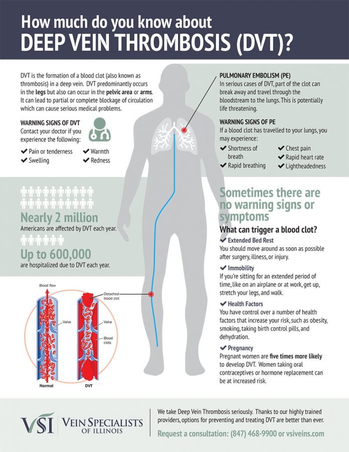 Why Leg Veins Become Visible