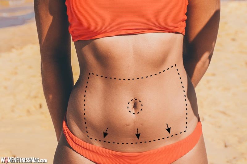 The 5 Most Common Myths About Tummy Tuck Surgery