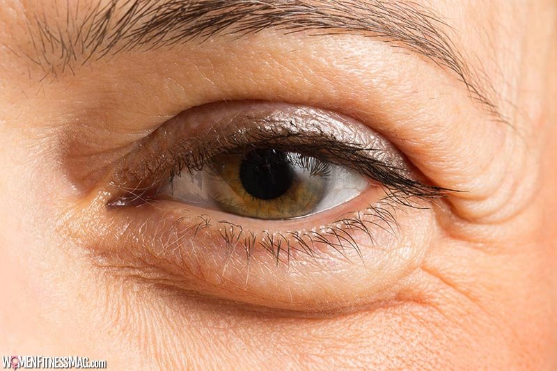 10 Reasons Why Your Eyelid is Swollen