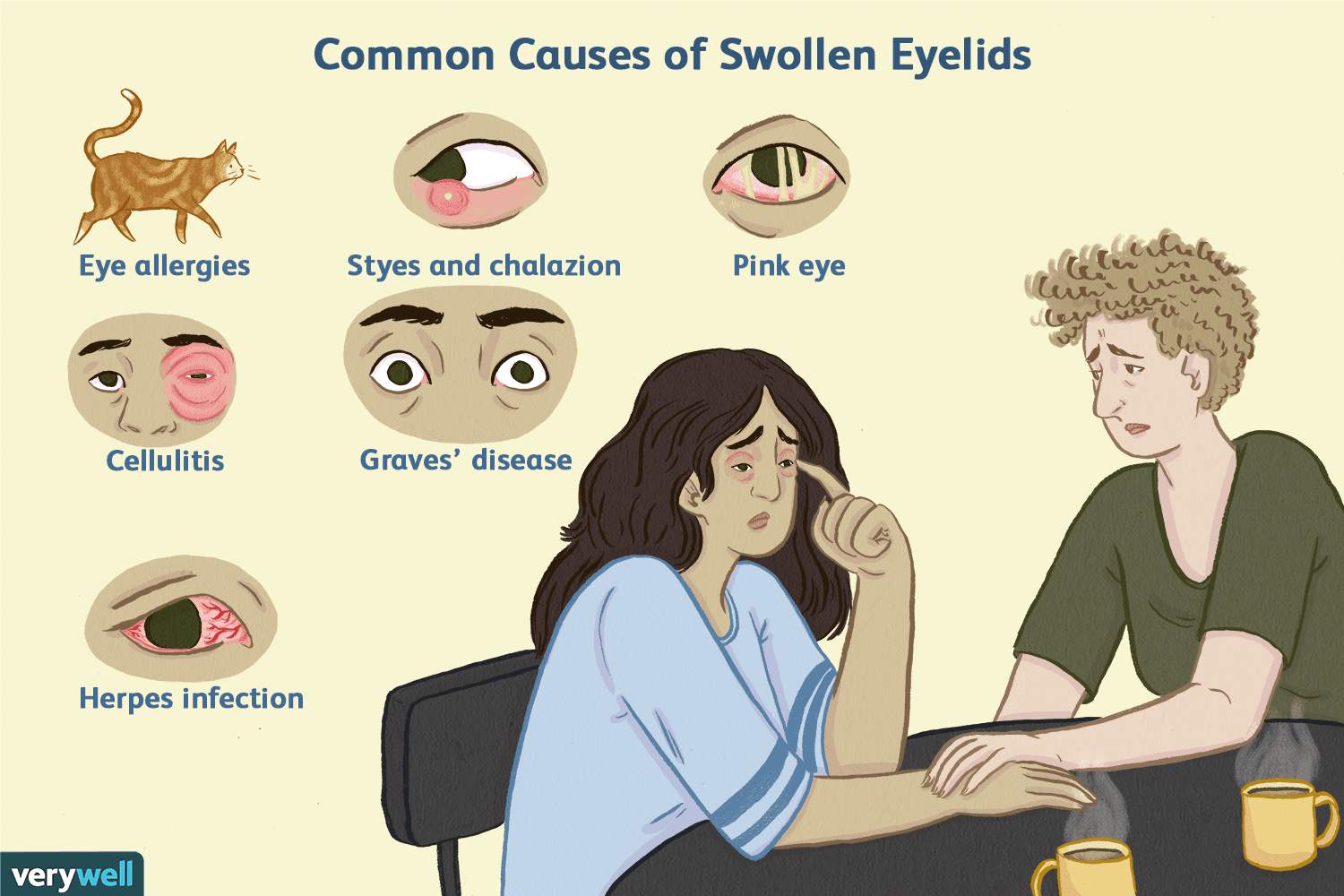 Common Causes of Swollen eyelids