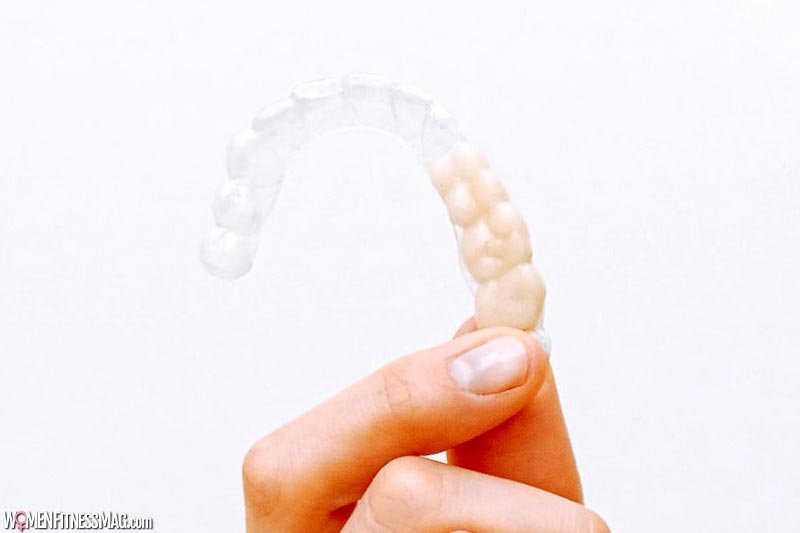 4 Clear Reasons to Choose Invisalign Over Braces