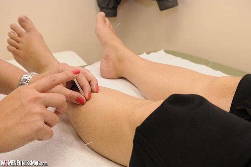 Acupuncture And Pregnancy: What To Expect