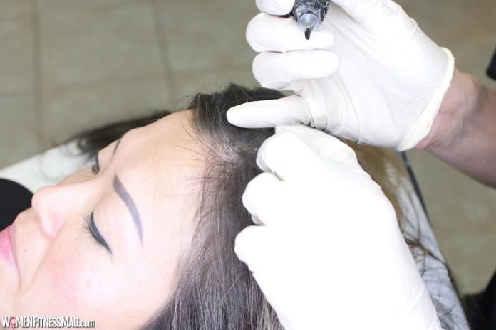 An Overall Guide To The Benefits Of Scalp Micropigmentation An Overall Guide To The Benefits Of Scalp Micropigmentation