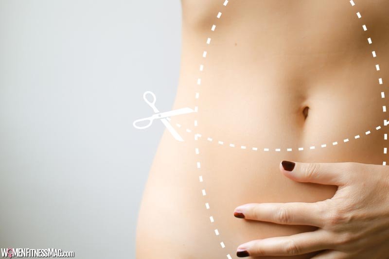 Struggling With Stubborn Body Fat? Consider Liposuction