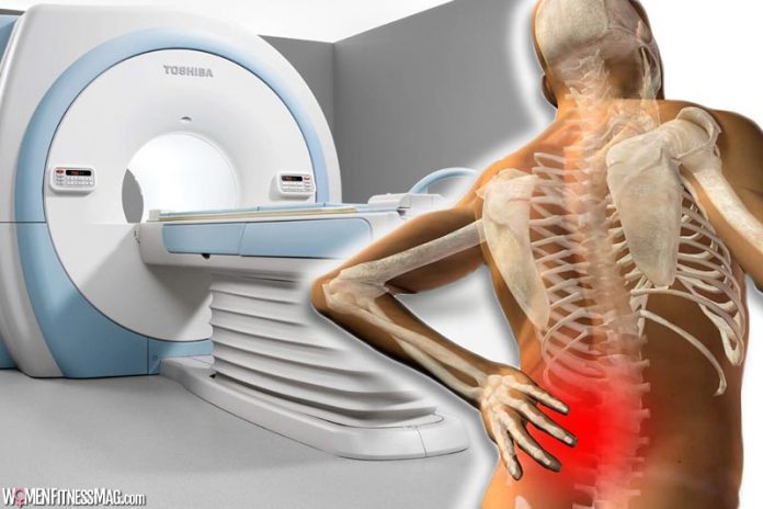 MRI for Patients with Lower Back Pain: When It is Necessary MRI for Patients with Lower Back Pain: When It is Necessary