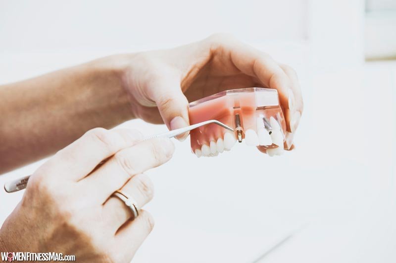 Are You the Right Candidate for Getting Dental Implants?