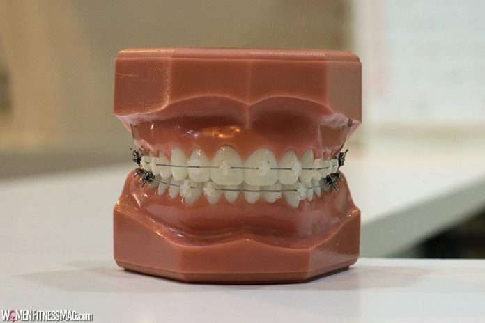 Why a Wound Care Technique Such As Platelet-Rich Fibrin Can Take Care of Your Dental Needs