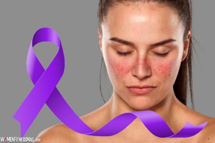 Managing Lupus: 3 Types of Specialists that Treat Lupus Managing Lupus: 3 Types of Specialists that Treat Lupus