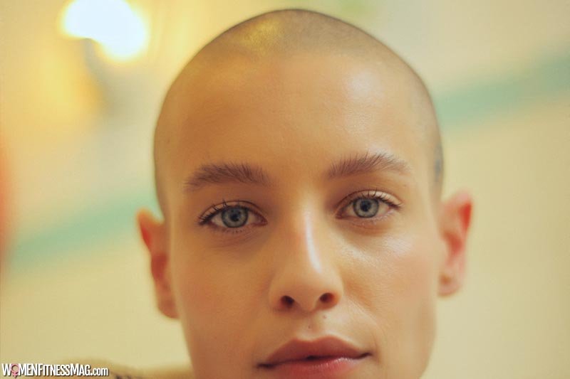 Everything You Need to Know About Going Bald