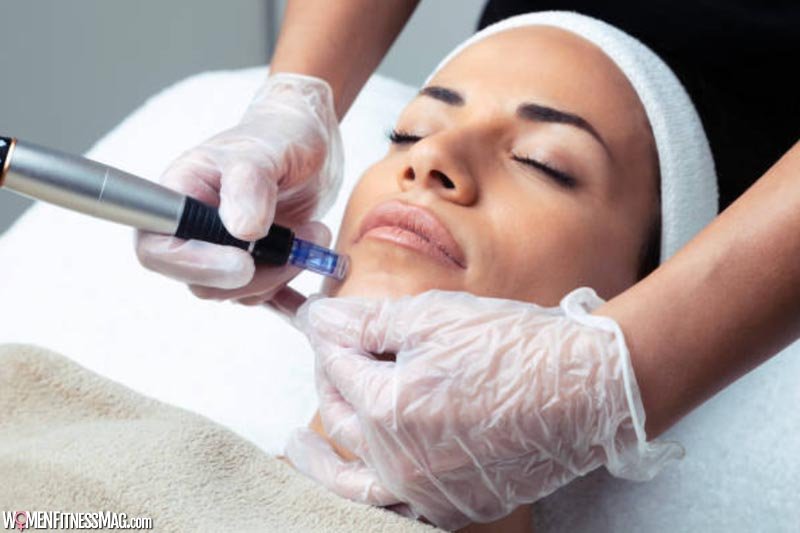 Restore Your Youthful Beauty With Microneedling Treatments