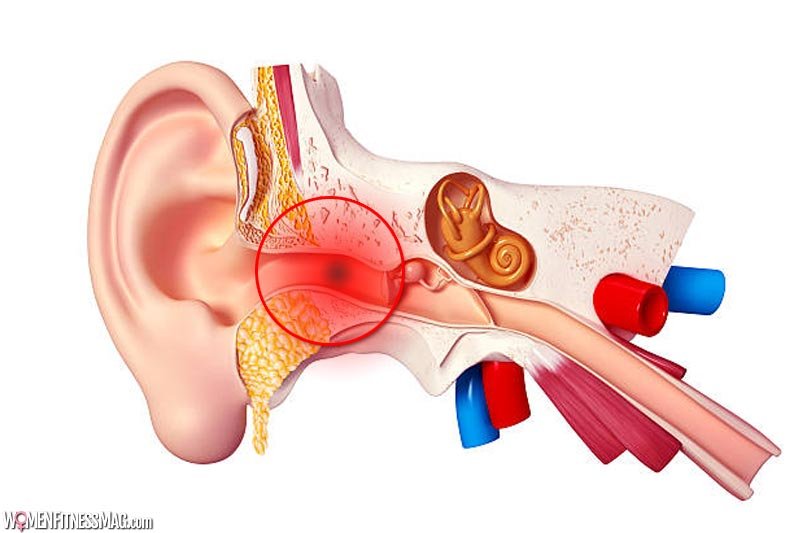 What Are Middle Ear Infections