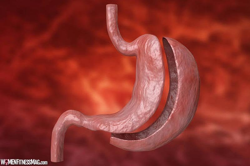 When The Best Time Is To Have Bariatric Surgery?