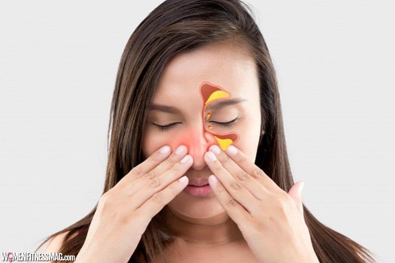 Signs That You May Need a Sinus Surgery
