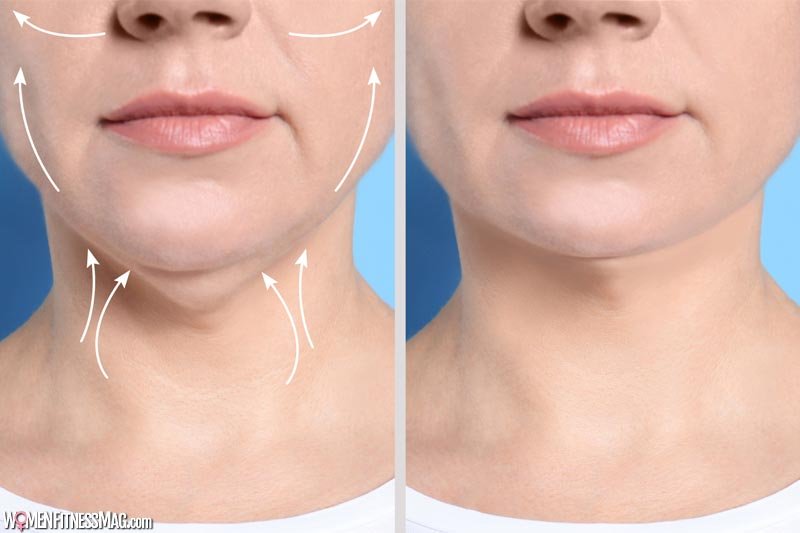 8 Questions To Ask Your Doctor Before Getting A Facelift