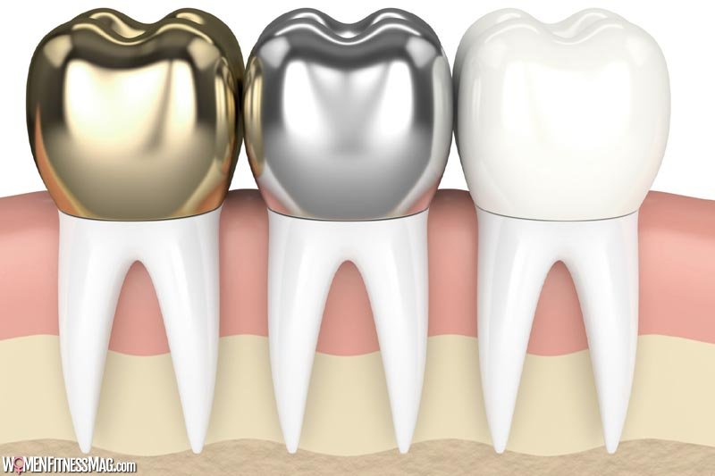 How Much Do Dental Crowns Cost In Austin