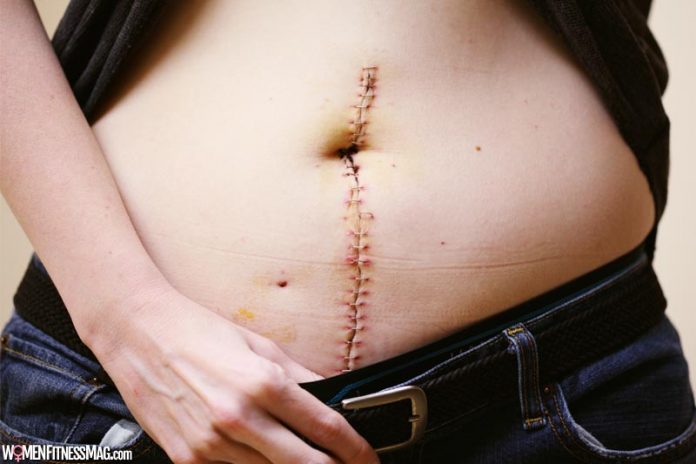 3 Tips for Recovering From an Operation 3 Tips for Recovering From an Operation