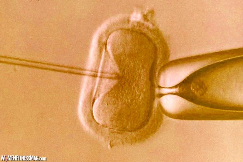 Debunking Common Myths about IVF