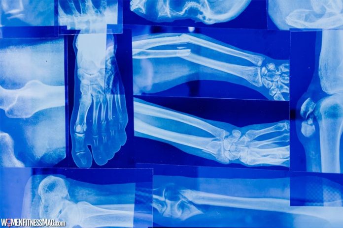 Most Common Types of Orthopedic Surgeries Most Common Types of Orthopedic Surgeries