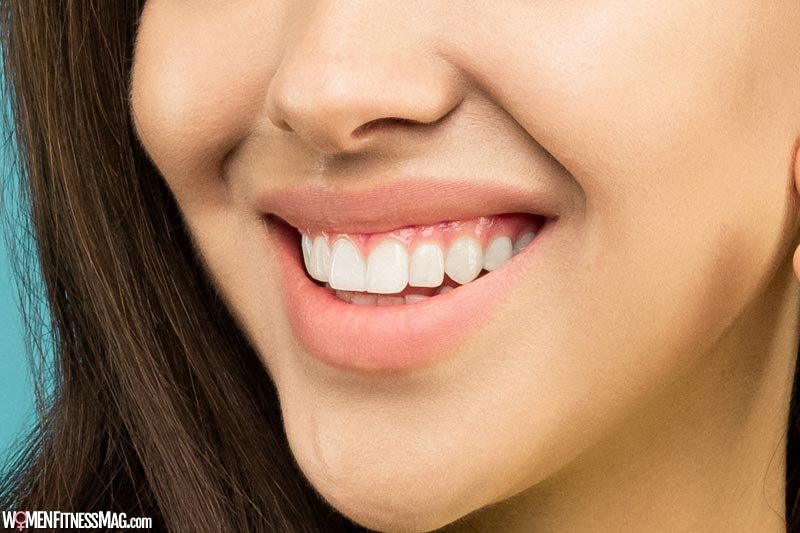 Teeth Aligners: How to Straighten Teeth Safely in 2022?