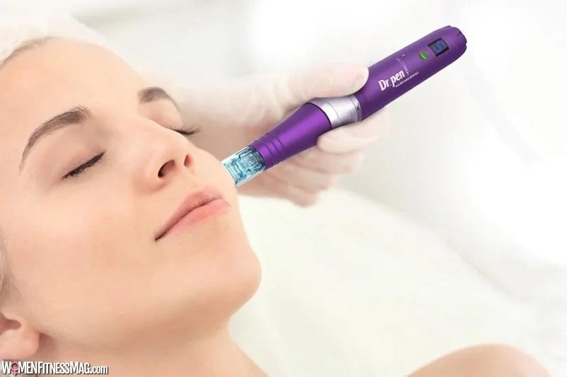 How To Start Microneedling Treatments?